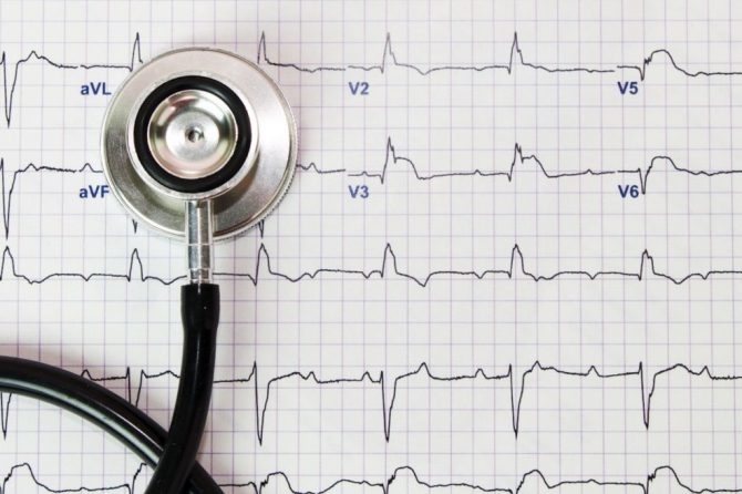 Электрокардиография (ЭКГ)